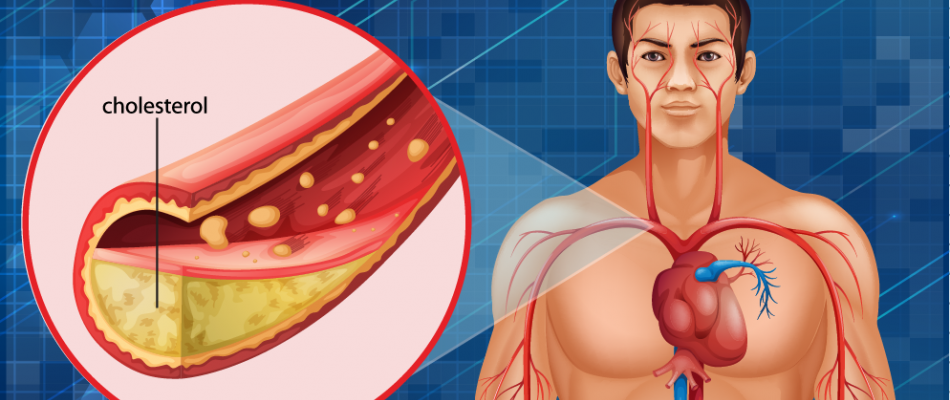 cholestérol détails 