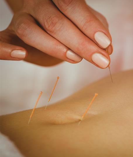 Clinique du Centre - Médecine chinoise et acupuncture