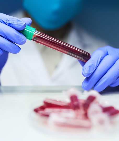 Hématologie tunisie